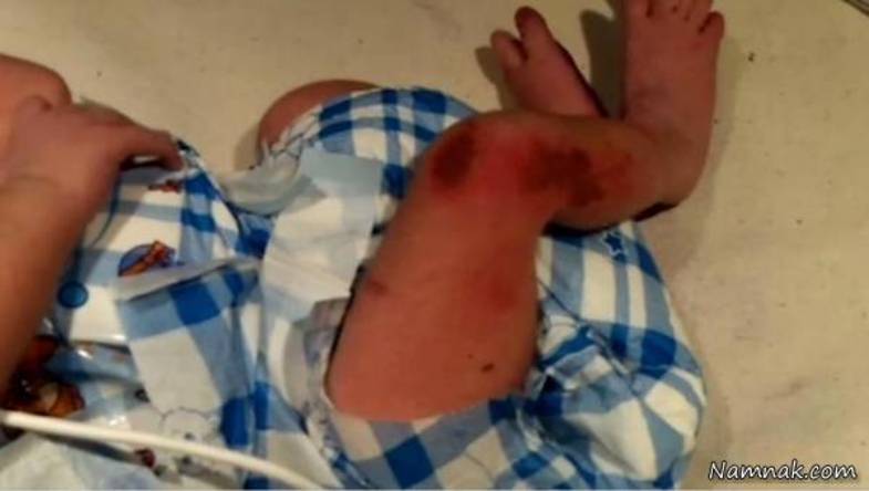 مورچه‌ها نوزاد دختر را زنده زنده خوردند! +تصاویر