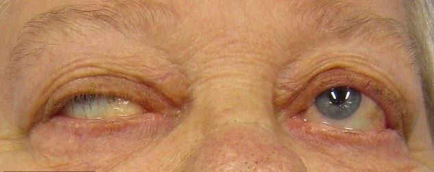 ویروس کرونا 