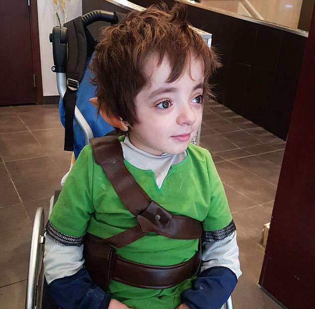 کودکی که دچار ۵۰۰ بار شکستگی اعضای بدن شده است + تصاویر