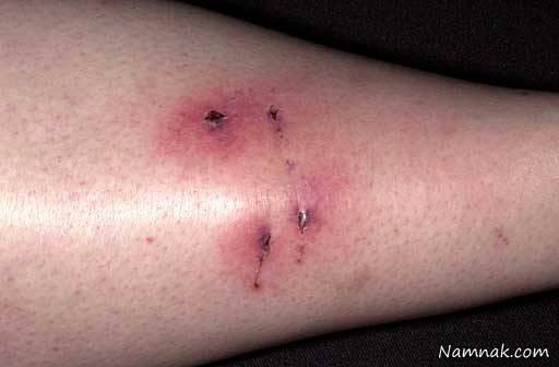 خطرات گازگرفتگی سگ گازگرفتگی سگ