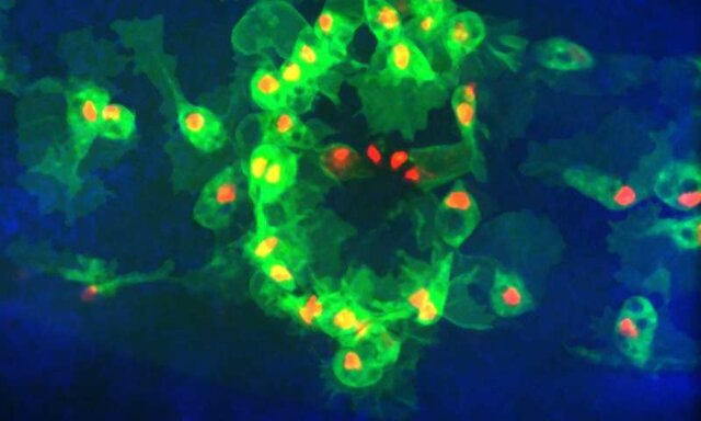 سلول‌های مرده می‌توانند عملکرد سیستم ایمنی را مختل کنند