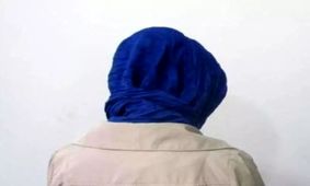 یک آرایشگاه زیبایی چگونه صورت یک زن را از ریخت انداخت؟/ عکس

