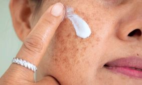 هرگونه تغییر در خال پوستی خود را جدی بگیرید
