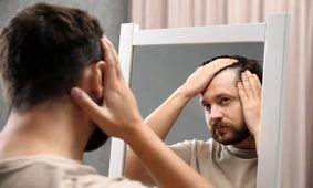 چربی سوزی کچلی را درمان می کند
