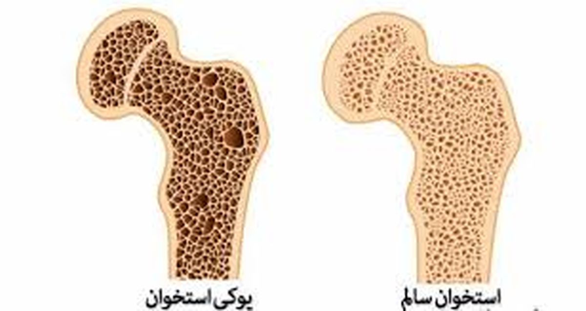 بیماری که مردان 35 تا 50 ساله را تهدید می کند