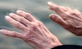 تشخیص پارکینسون 20 سال زودتر از بروز علایم آن