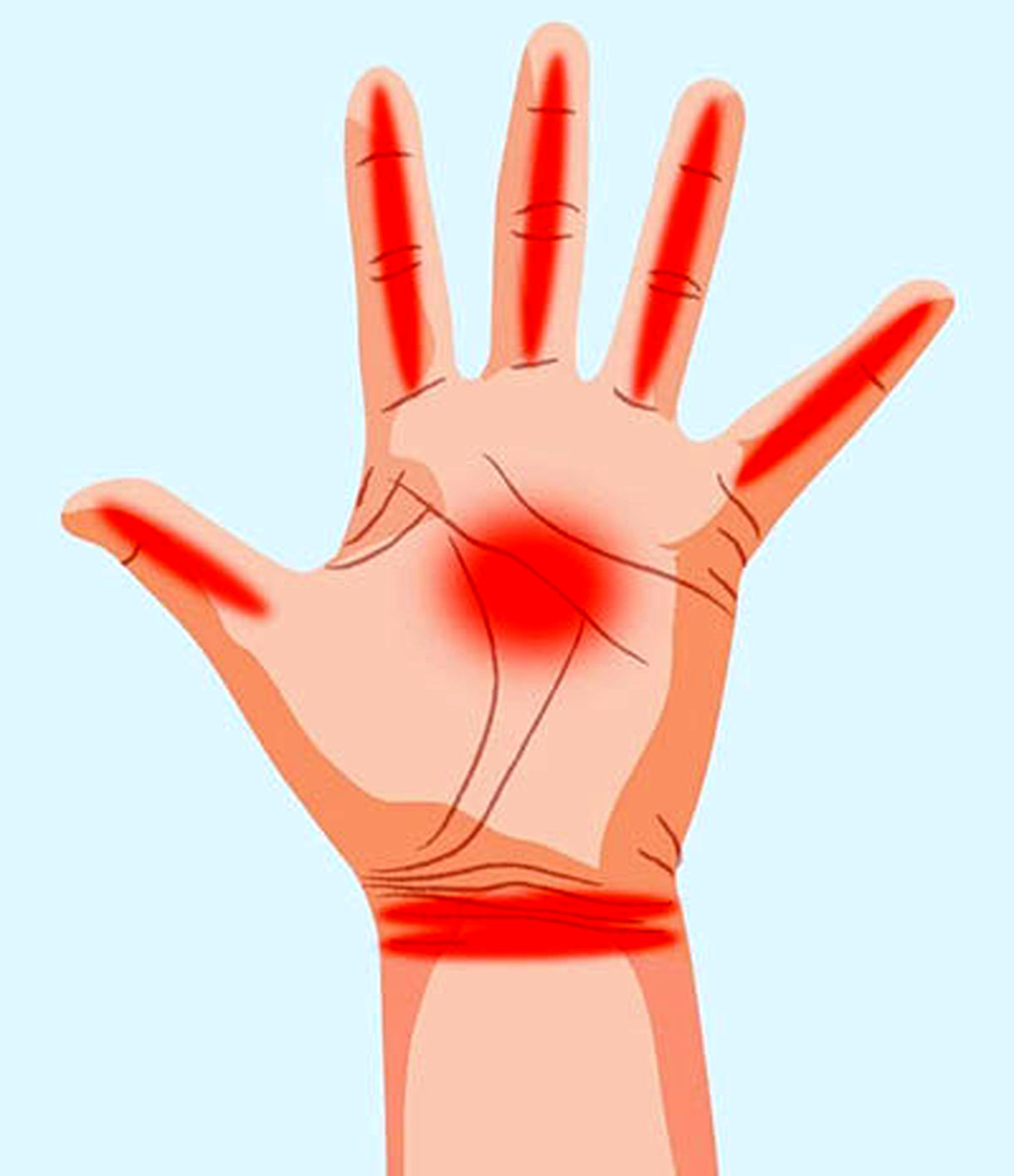دست ها چه چیزهایی درباره سلامت ما می گویند
