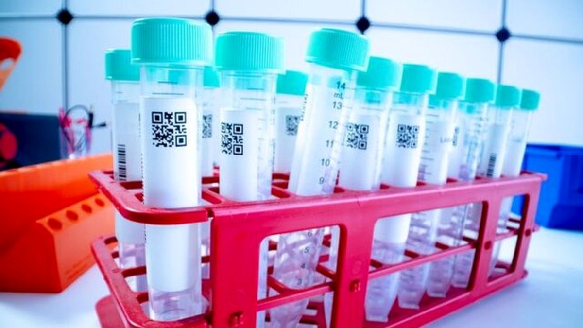 قیمت‌های مجاز تست کرونا در آزمایشگاه‌ها