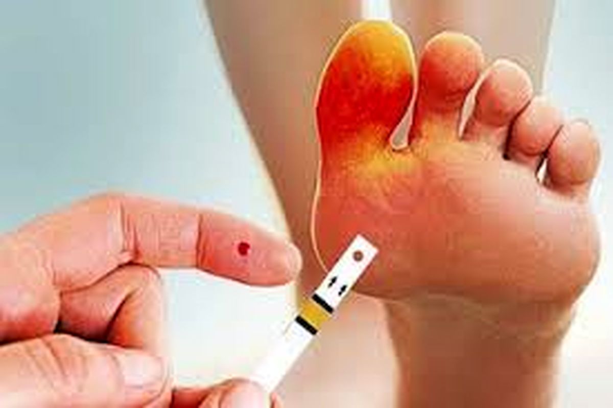 هر ۲۰ ثانیه، یک پای دیابتی قطع می‌شود
