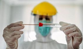 بهترین زمان برای انجام تست pcr و سی‌تی اسکن چند روز بعد از ایجاد علائم است؟