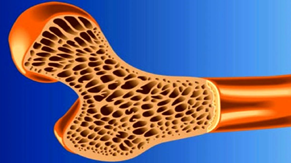 دلایل سروصدای زانو چیست؟