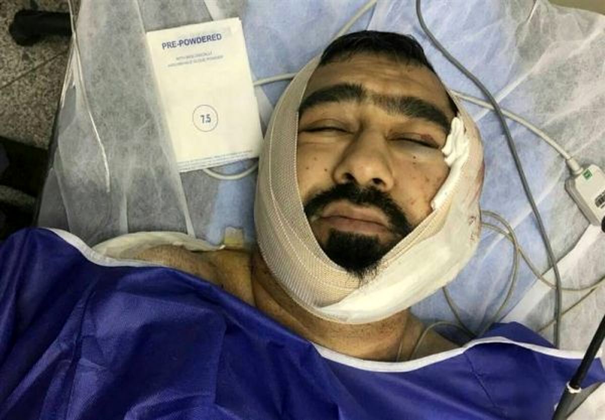 حمله خونین یکی از اوباش منطقه شرق تهران به یک طلبه +عکس