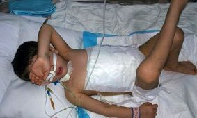 دریده شدن شکم کودک ۵ ساله توسط سگ