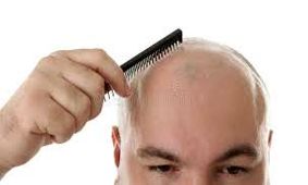 ریزش مو نشانه کدام بیماری است؟
