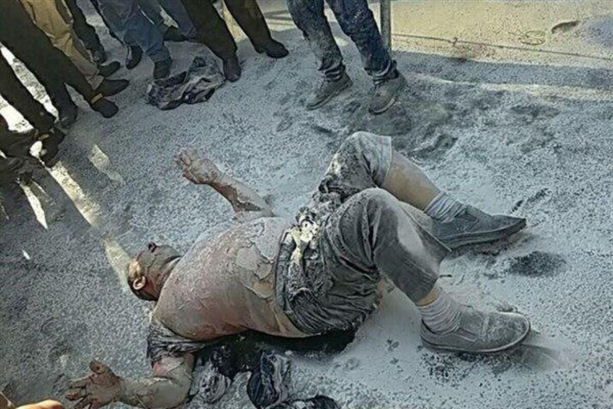 آخرین وضعیت جسمانی عامل خودسوزی مقابل شهرداری تهران