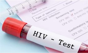 آخرین وضعیت واکسن HIV / انگ اجتماعی بزرگ ترین مانع در کنترل این بیماری
