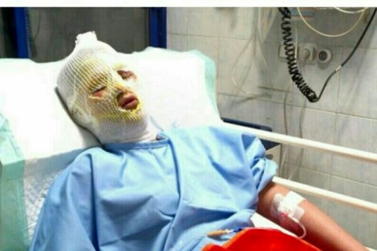 ۲۱ نفر در حوادث چهارشنبه آخر سال گیلان مصدوم شدند