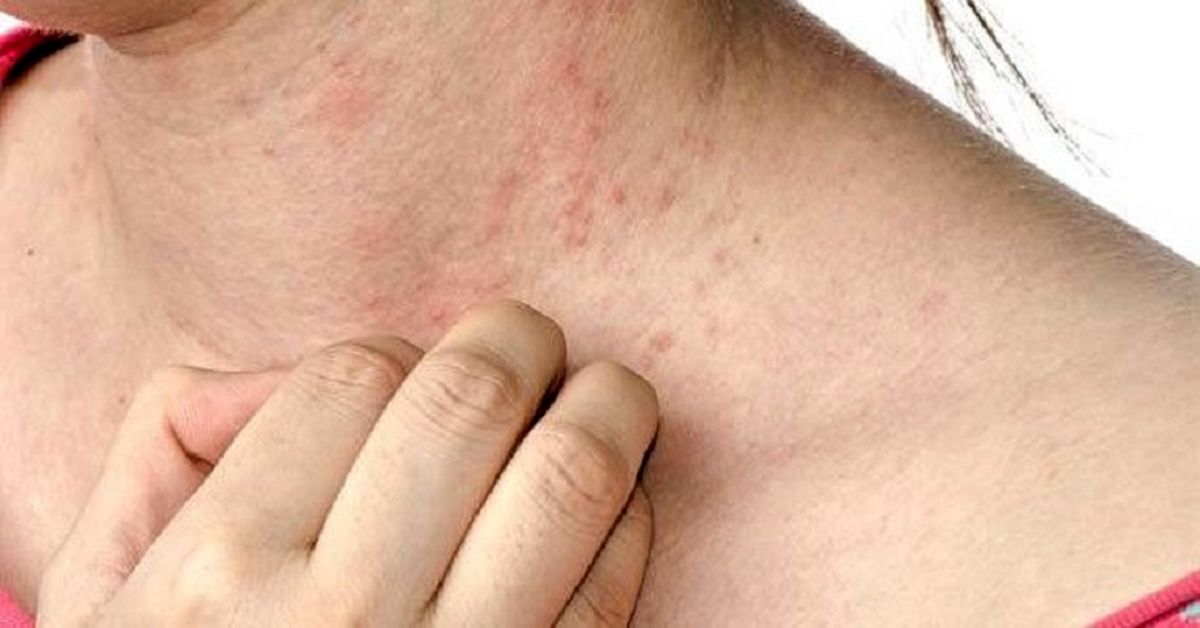 فصل بهار با پوست شما چه می‌کند؟