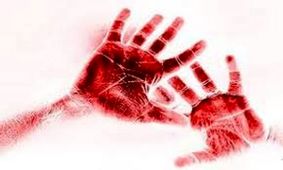 قتل خواهر و خودکشی برادر به خاطر ترنس بودن/ مگر تراجنسیتی بودن جرم است؟