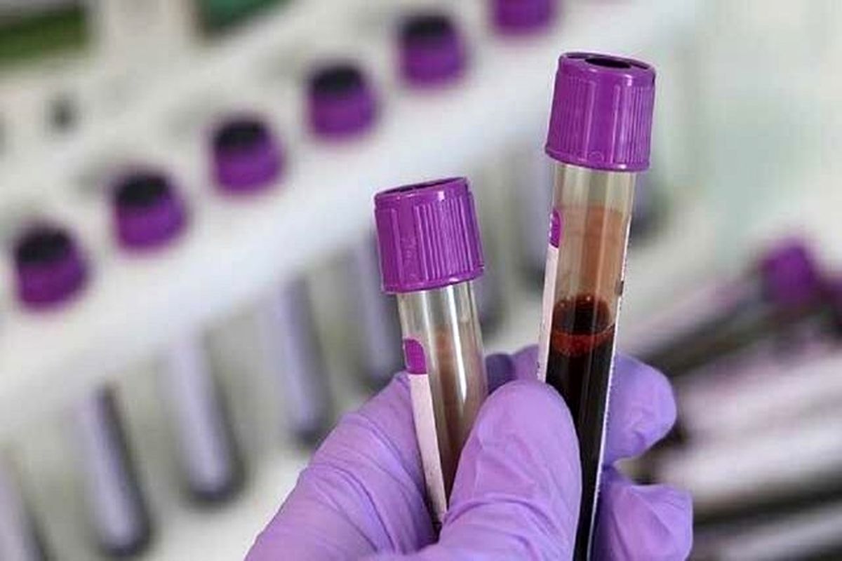 پیش بینی مرگ یا معلولیت بیماران آسیب مغزی با یک آزمایش خون ساده