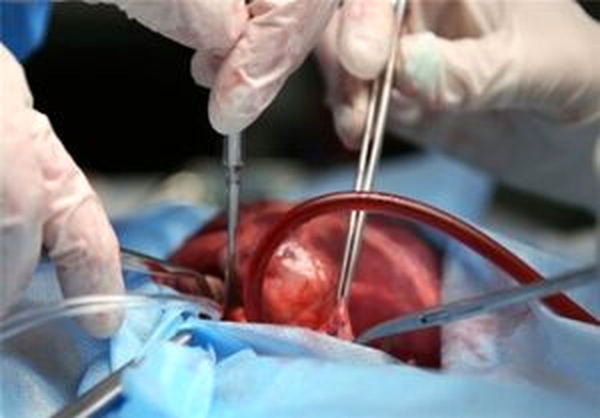همدستی شوهر و پزشک برای فروش کلیه یک زن