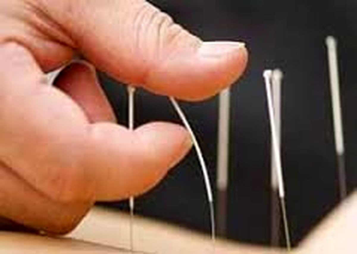 طب سوزنی می تواند به پیشگیری از دیابت کمک کند؟