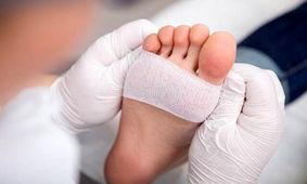 ابداع یک هیدروژل جدید برای درمان زخم‌های دیابتی

