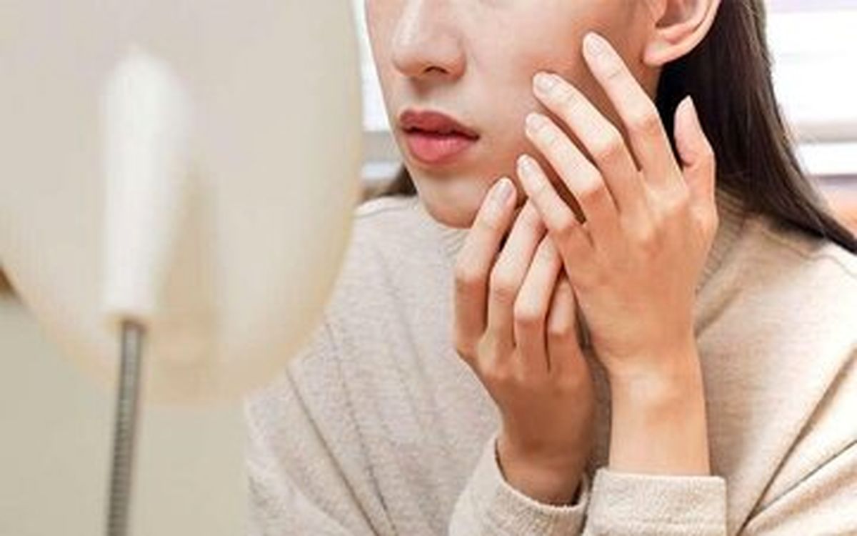 زیبایی پوست صورت به کمک طب سنتی