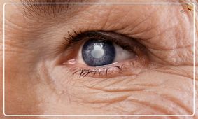آب مروارید؛  شایع ترین علت نابینایی/  ویدئو
